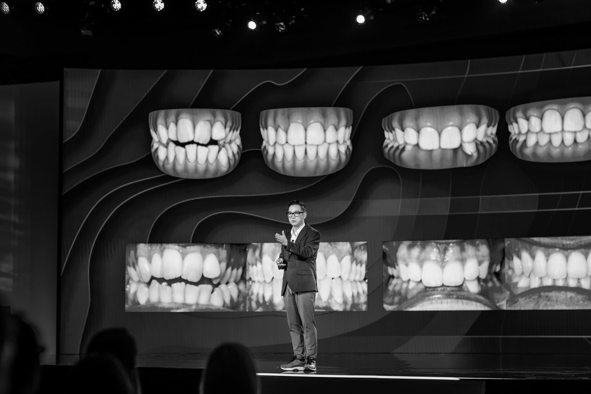 Digital treatment visualization presented on stage
